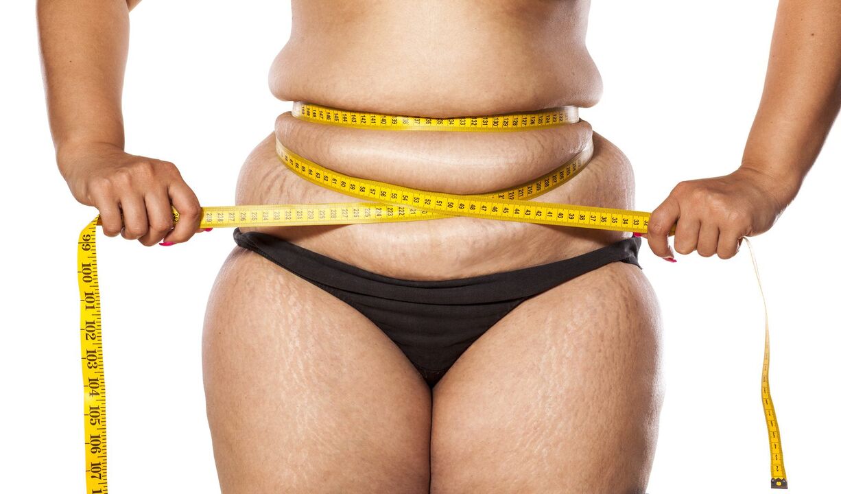 Excess weight and weight loss with the help of Keto Probiotix